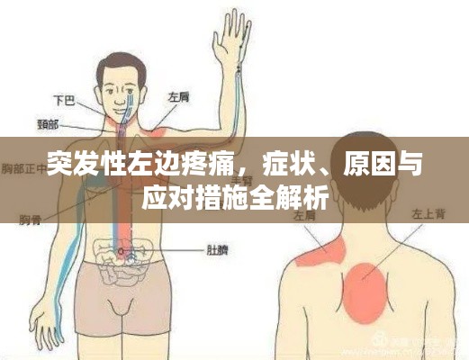 突发性左边疼痛，症状、原因与应对措施全解析