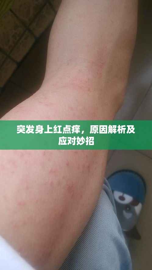 突发身上红点痒,原因解析及应对妙招